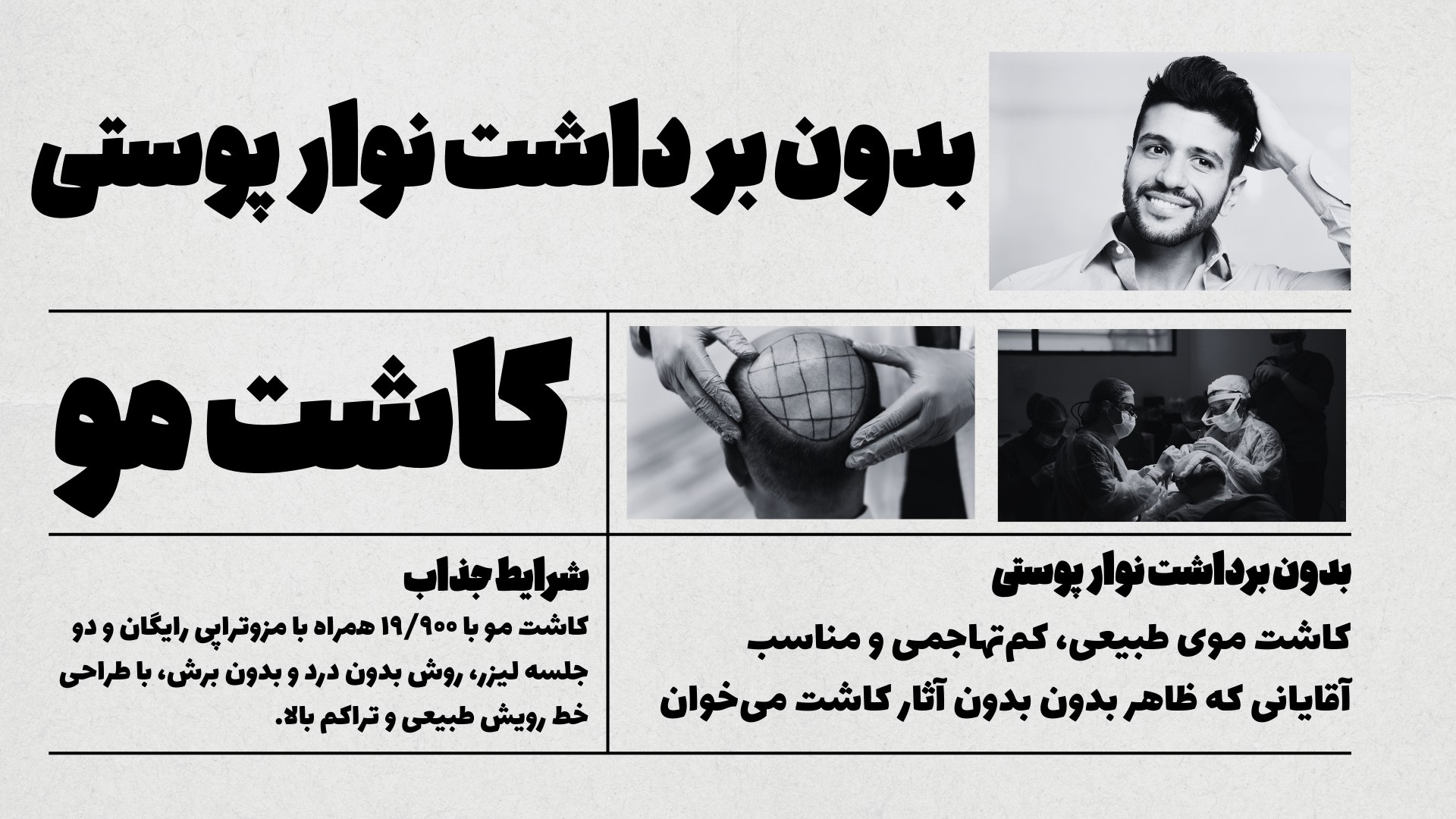 کاشت ابرو و مو /سلبریتی متد🥰
